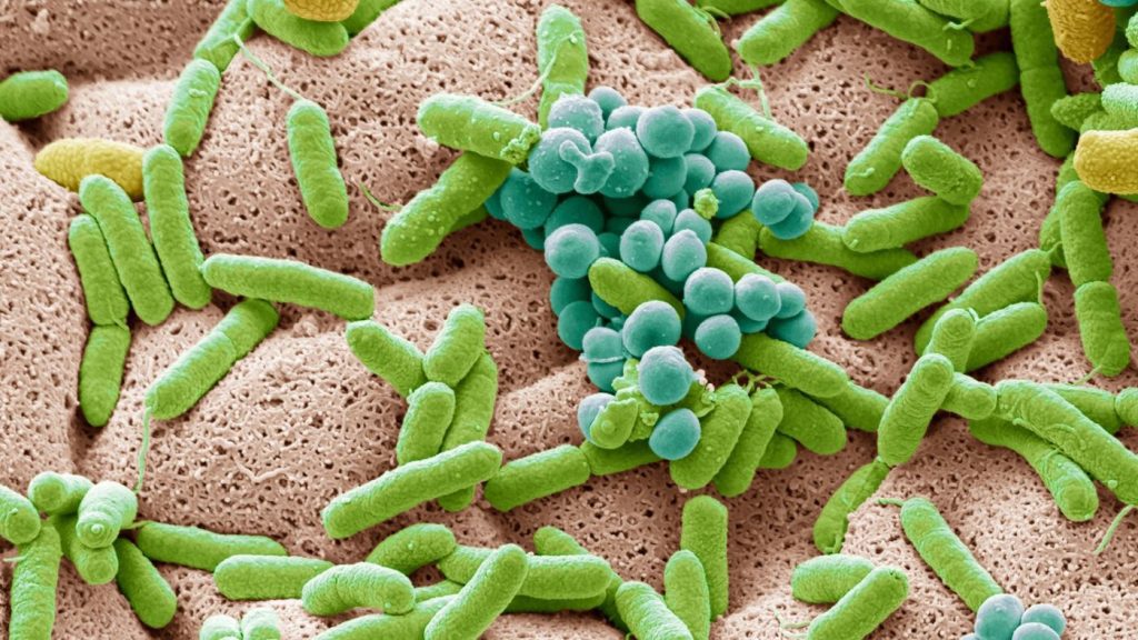 Listeria prevenzione sicurezza alimentare