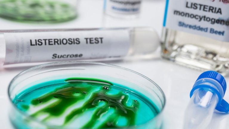 Listeria novità normative